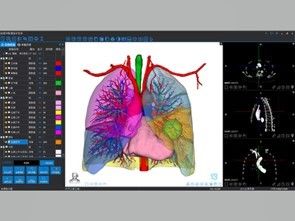 Servizi di ricostruzione 3D medica e di stampa 3D